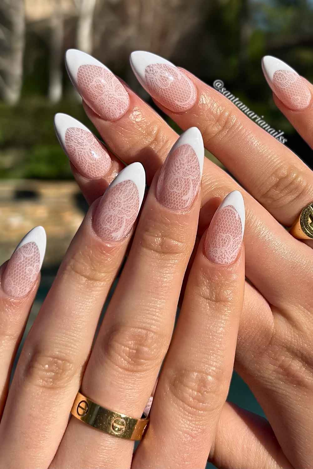 Medium Almond Lace French Nails Medium Almond Lace French Nails — Lace Nails